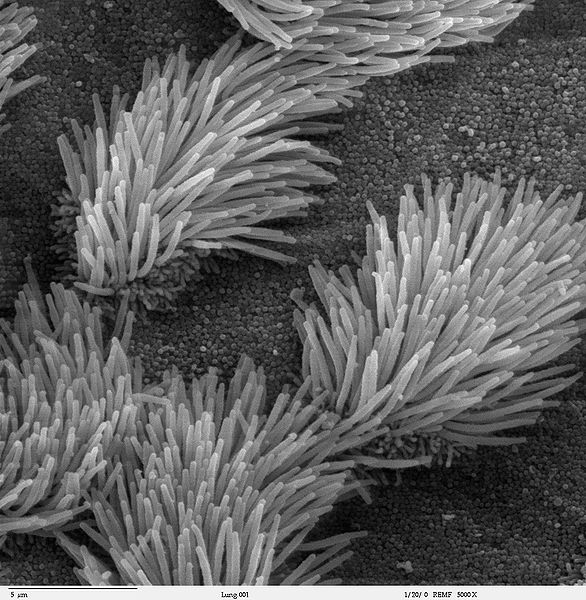 Scanning electron microscope image of lung trachea epithelium showing both ciliated and non-ciliated cells